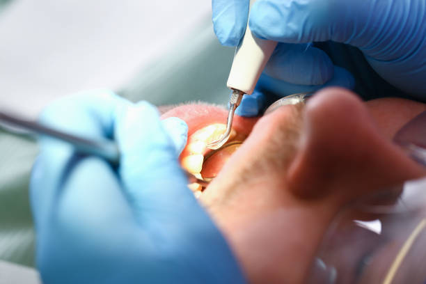 Best Emergency Dentist for Knocked-Out Tooth in Gonzales, CA
