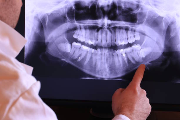 Best Emergency Dental Extractions in Gonzales, CA