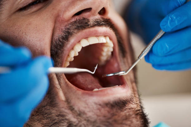 Best Pediatric Emergency Dentist in Gonzales, CA